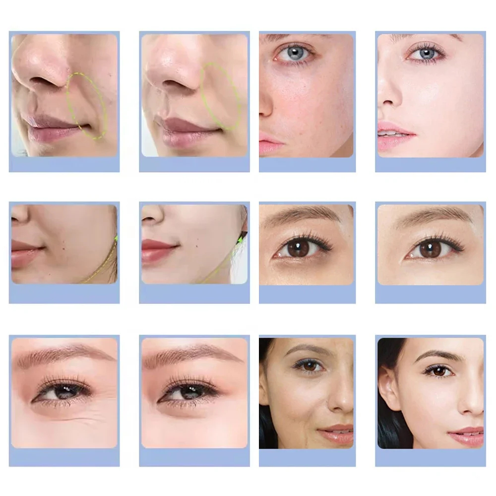 7 Types Facial CO2 Oxygen Bubb - Health Wellness Massage review and price