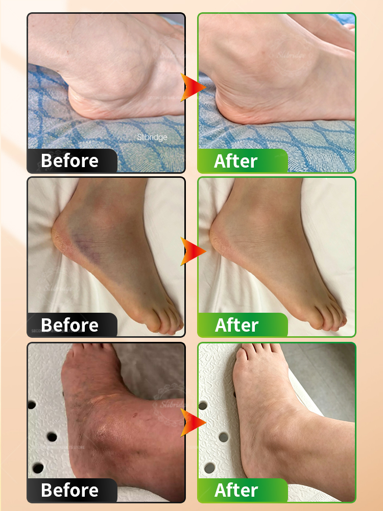 Portable Heated Ankle Massager - Ankle Brace Support review and price